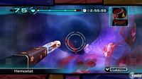 E3: Regresa al quir�fano con Trauma Team