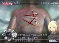Pantalla Trauma Center: Second Opinion