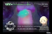 Imagen 11 de Trauma Center: Second Opinion para Wii