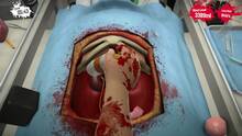 Imagen 31 de Surgeon Simulator Anniversary Edition