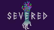 Imagen 39 de Severed